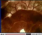 Peristaltisme intestinal vidéo