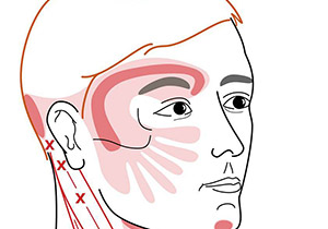 Points Trigger Myofasciaux Points Trigger Myofasciaux