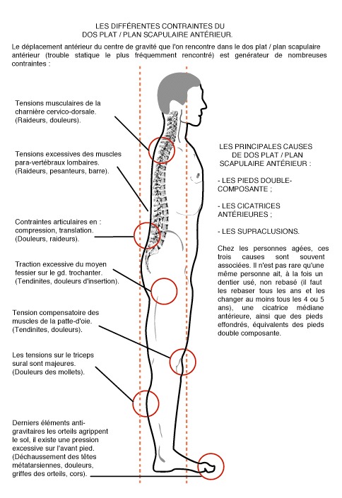 Intérêt de la posturologie en kinésithérapie et ostéopathie