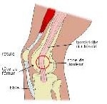 FORMATION EN LIGNE : Syndrome de l'essuie glace : présentation