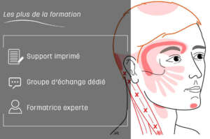 Points Trigger Myofasciaux