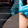 Dry Needling et Syndromes Canalaires