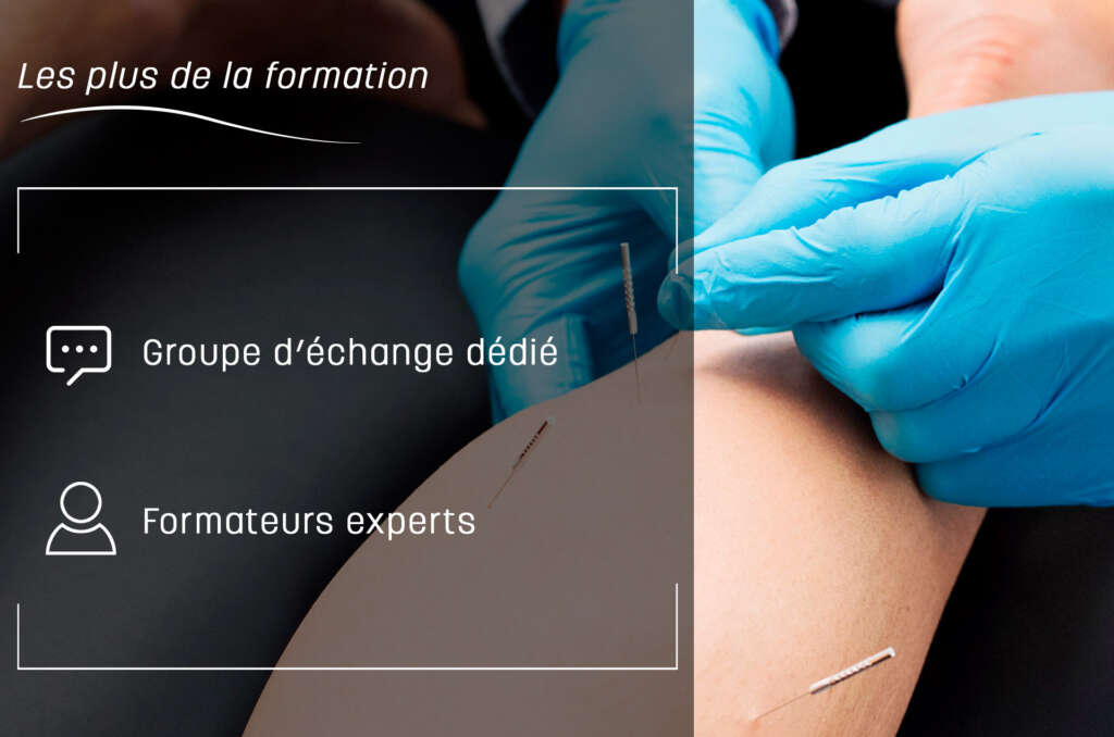 Dry Needling et Syndromes Canalaires