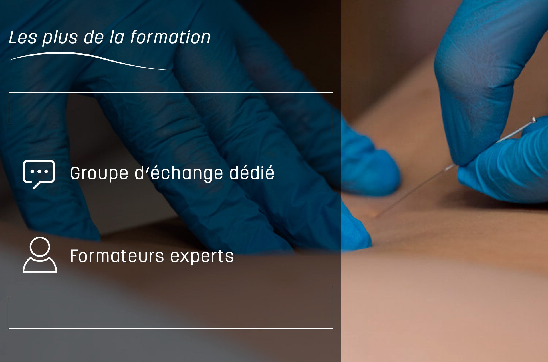 Muscle extenseur ulnaire du carpe : douleurs et trigger points